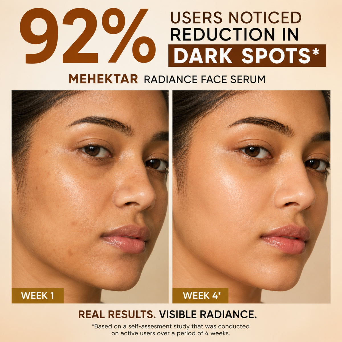 MEHEKTAR Radiance Face Serum with Niacinamide & Zinc PCA, 30 ml